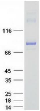 Coomassie blue staining of purified TBK1 protein.